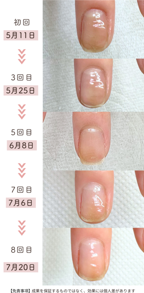 O様 女性/30代/パート
お悩み：皮膚むしり症の3ヶ月育成過程症例