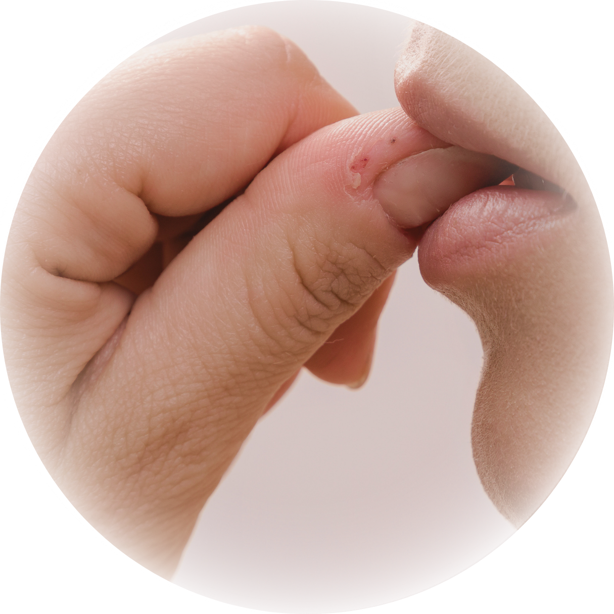 深爪/噛み癖/二枚爪/爪の不揃いをどうにかしたい