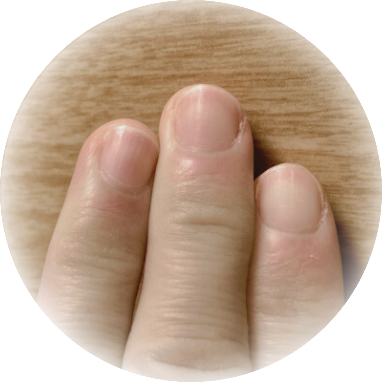 爪の形は生まれつき変わらないと思い、指先のオシャレを諦めている