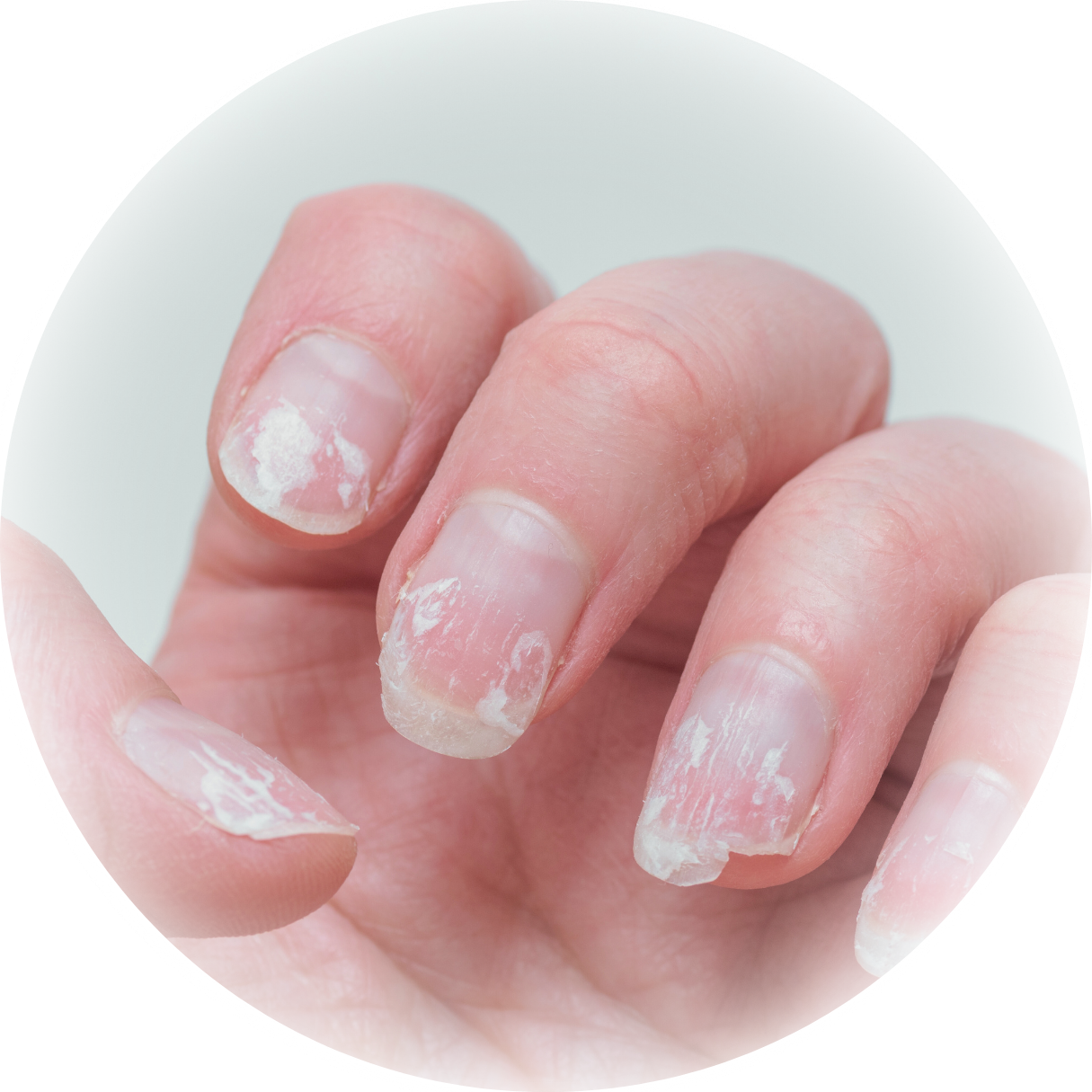 ジェルネイルをしたら爪が薄くボロボロになってしまった